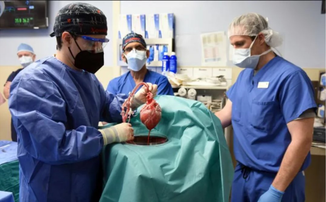 ¡Increíble! Trasplantan con éxito un corazón de cerdo a un hombre