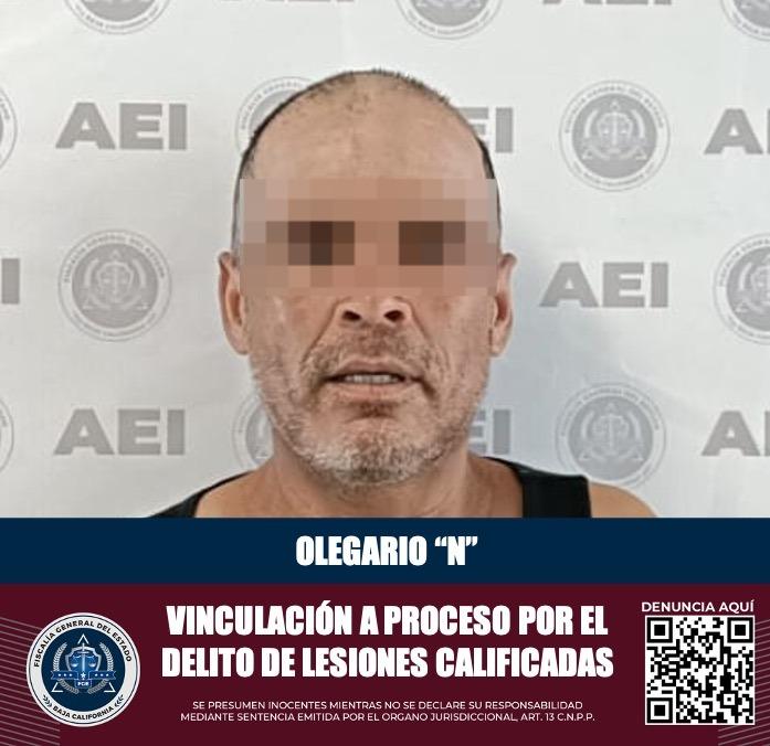 FGE vincula a proceso a un hombre acusado de lesiones