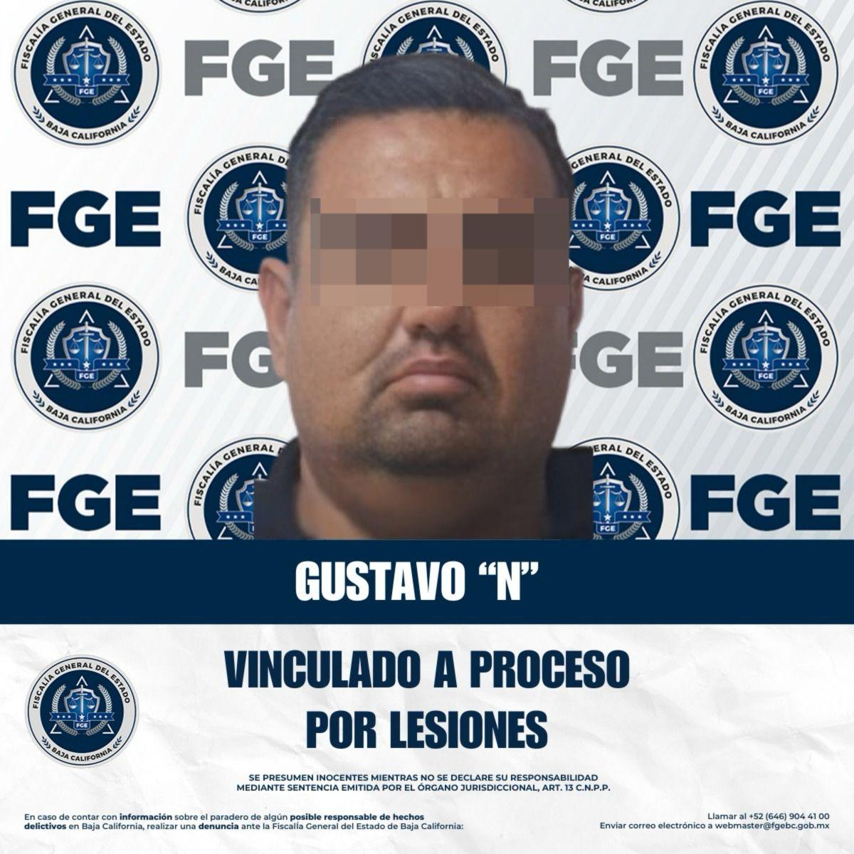 Vinculado a proceso por el delito de lesiones