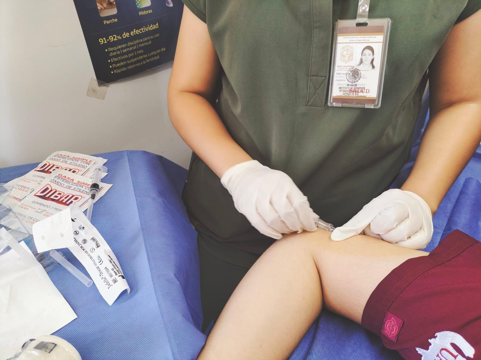 Se aplicaron 4 mil 200 implantes anticonceptivos en 2025 en Tijuana, Tecate y Playas de Rosarito