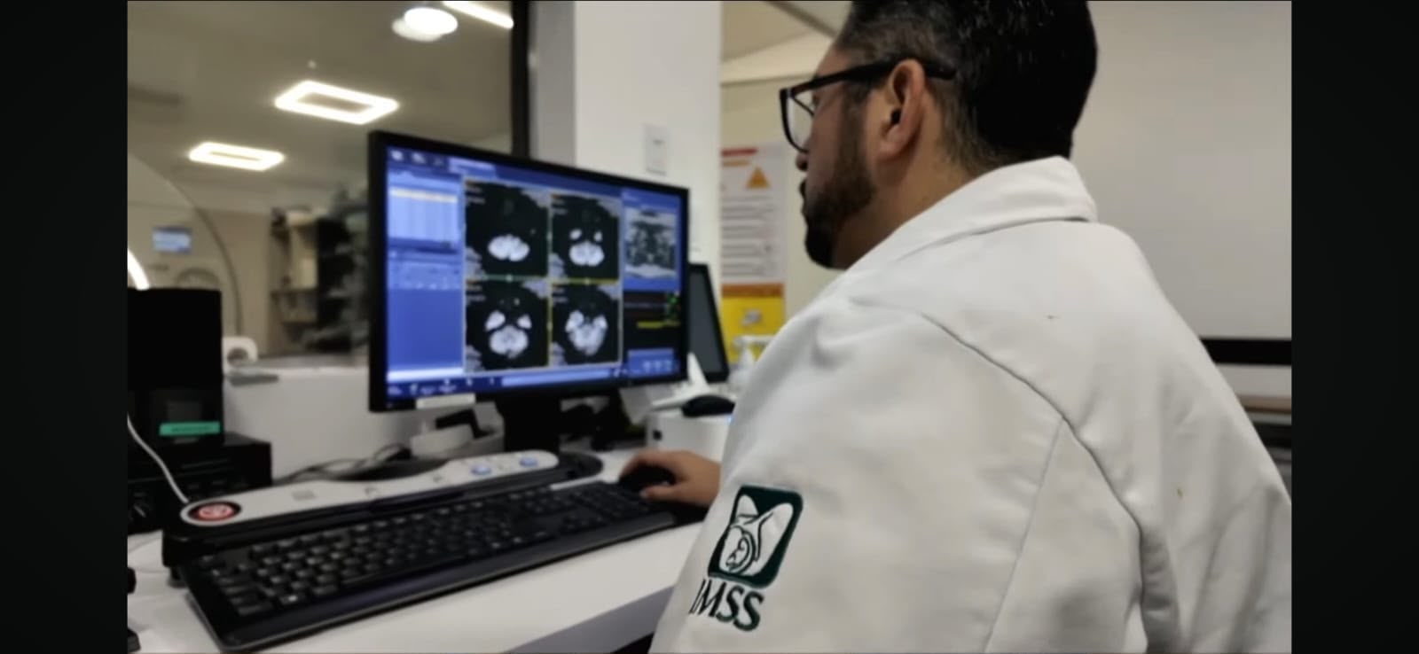 Llama IMSS Baja California a identificar signos de alerta neurológica y acudir de forma oportuna a valoración médica